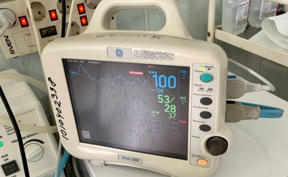 Внутренние песочные часы: удивительное открытие о том, как мозг управляет нашей координацией